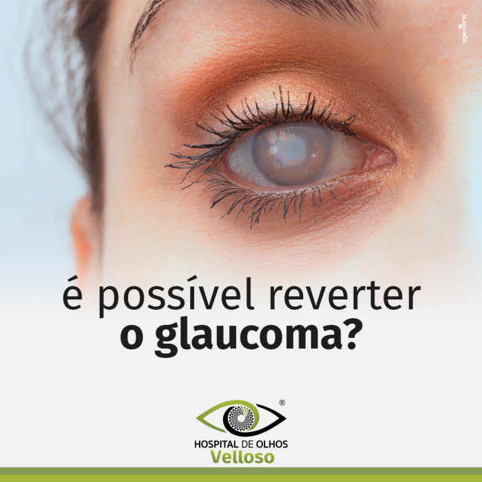O Glaucoma é Reversível?