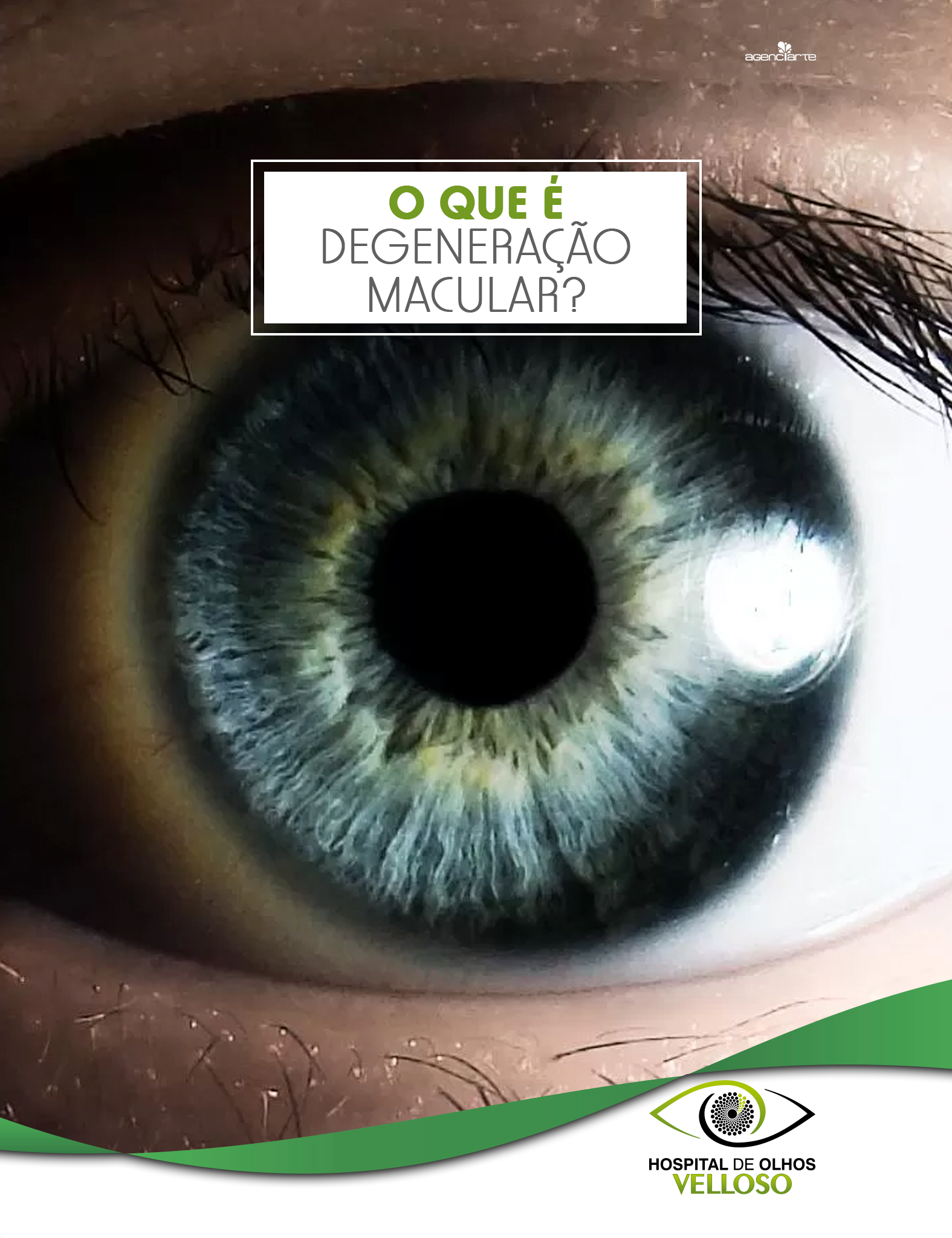 O QUE É DEGENERAÇÃO MACULAR?